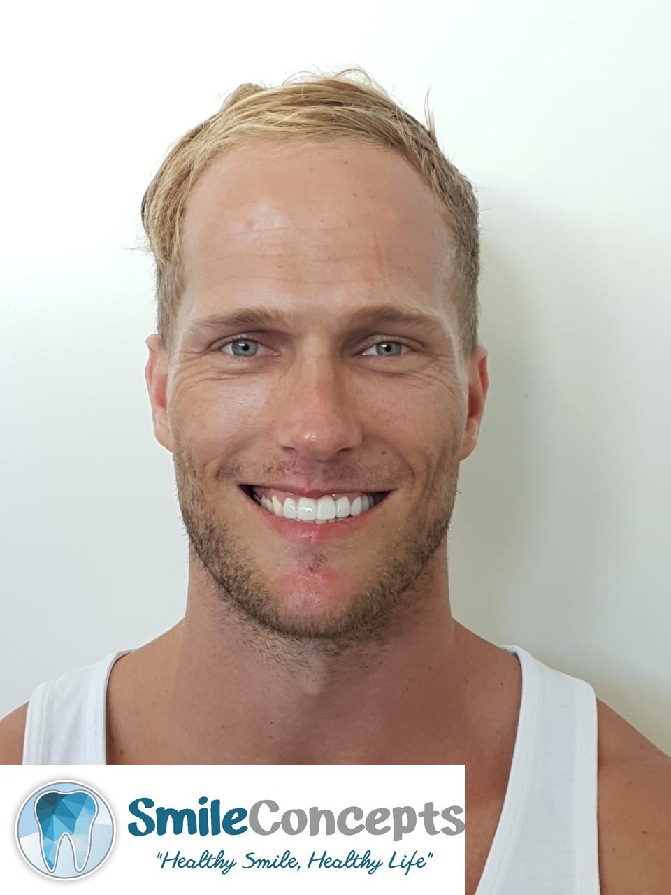 full mouth rehab after durban